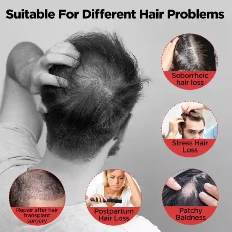 Hair Growth Cap Anti Hair Loss and Growth Laser Helmet Hat Hair Regrowth Light Therapy Device Relax Head Treatment Hat Machine